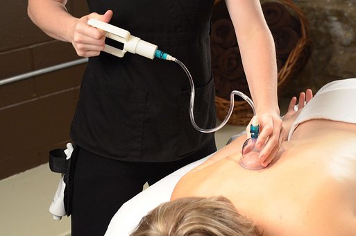 cupping therapy archives greenwich sports medicine